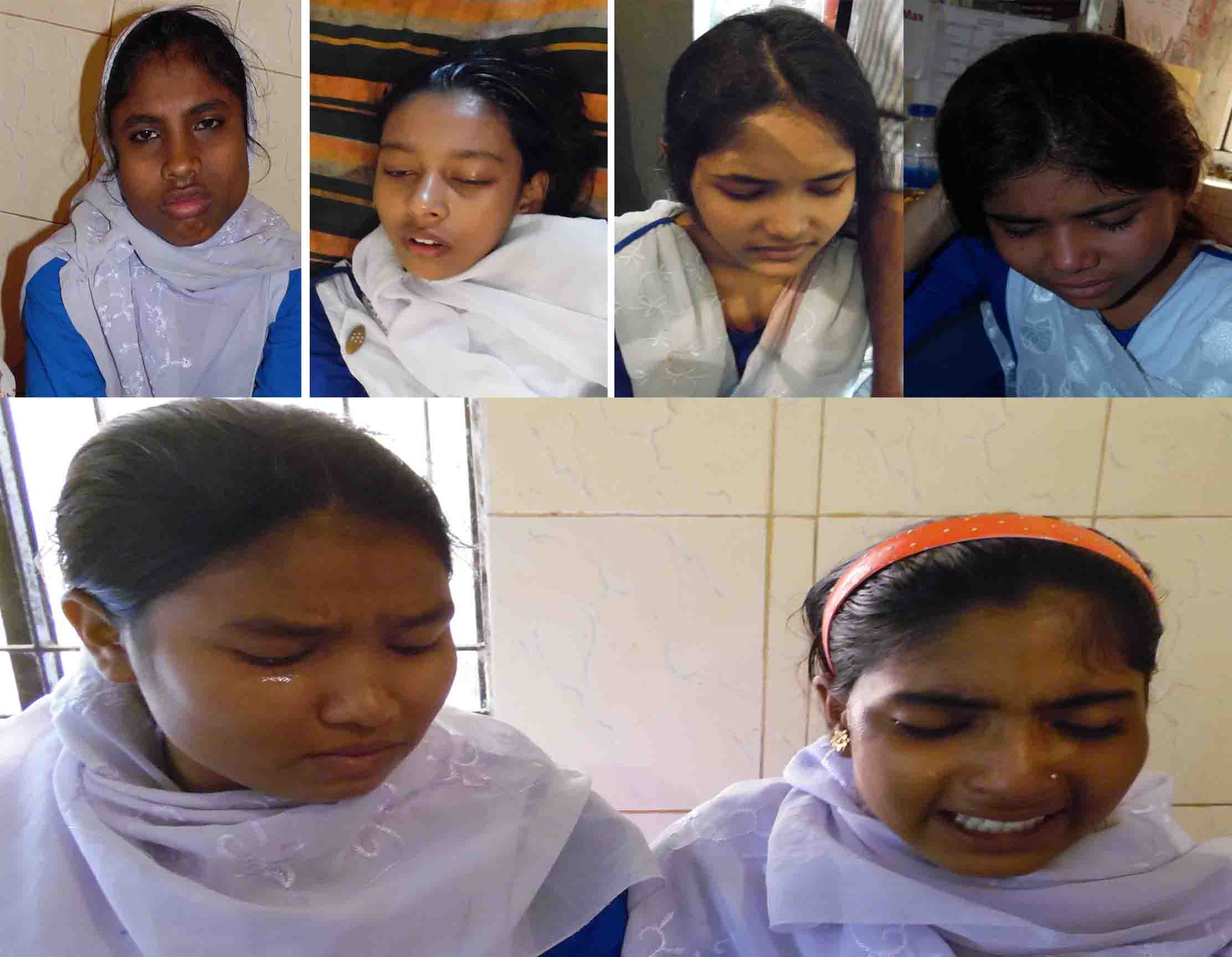 সোনাতলায় ভটভটি উল্টে ৬ জেএসসি পরীক্ষার্থী আহত