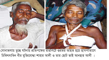 সোনাতলায় তুচ্ছ ঘটনায়  প্রতিপক্ষের মারপিটে  হাসপাতালে মুক্তিযোদ্ধা শাহার আলী