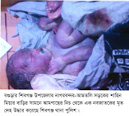 শিবগঞ্জে আমতলি থেকে এক নবজাতকের মৃত দেহ উদ্ধার