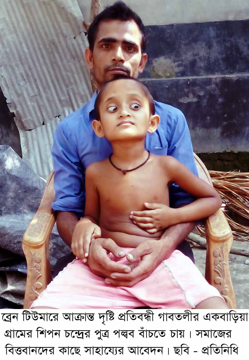 ব্রেন টিউমারে আক্রান্ত দৃষ্টি প্রতিবন্ধী পল্বব কে বাঁচাতে এগিয়ে আসুন