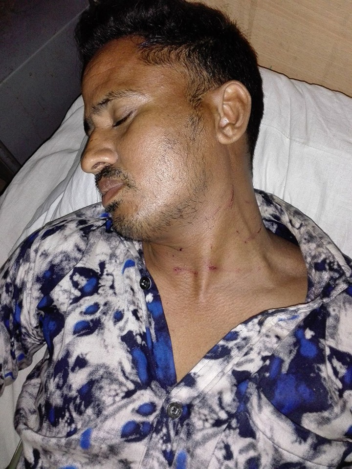 শিবগঞ্জে বসত বাড়ির রাস্তায় বেড়িগেট দিয়ে প্রতিবন্ধকতা সৃি তে বাঁধা দেওয়ায় মারপিটে আহত ২, থানায় অভিযোগ