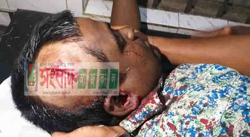 গোবিন্দগঞ্জে মাদক ব্যবসায়ীর হাতে গুরুত্বর আহত-১